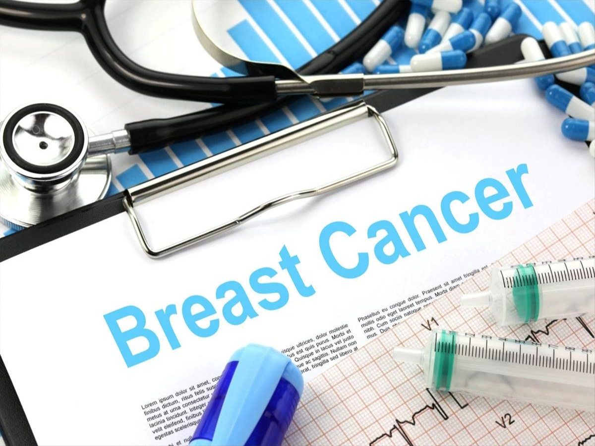 Breast cancer mortality rates higher for Black women across all types compared to White women – New study