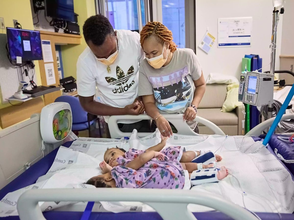 1 year-old formerly conjoined twins now home after separation surgery 