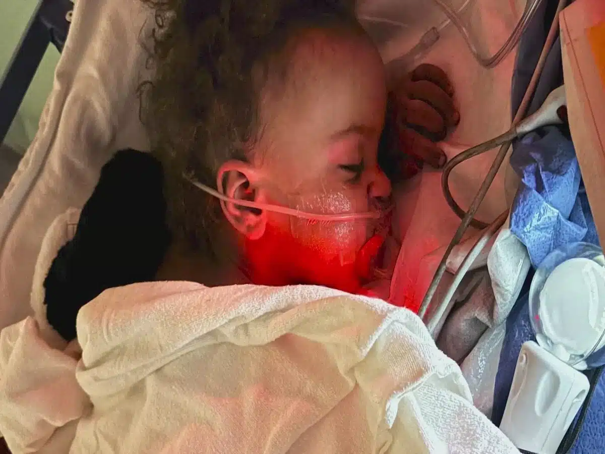 2-year-old gets second chance at life after heroic firefighter rescued him from burning apartment