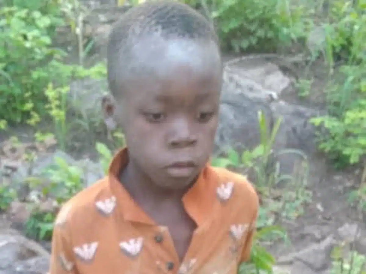 Zimbabwe: Boy survives after getting lost for 5 days in game park home to lions